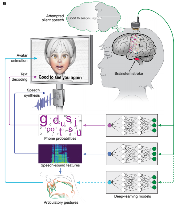 Process of how AI in healthcare restores the ability to speak